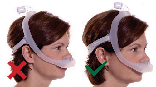 Philips DreamWear - Maske zu gro&szlig;