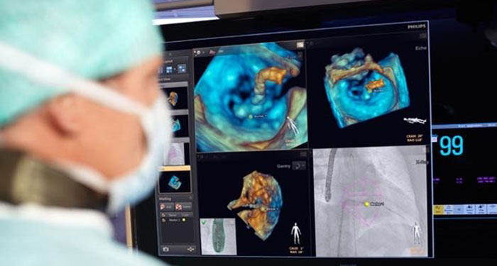 Weiterbildung Interventionelles R&ouml;ntgen