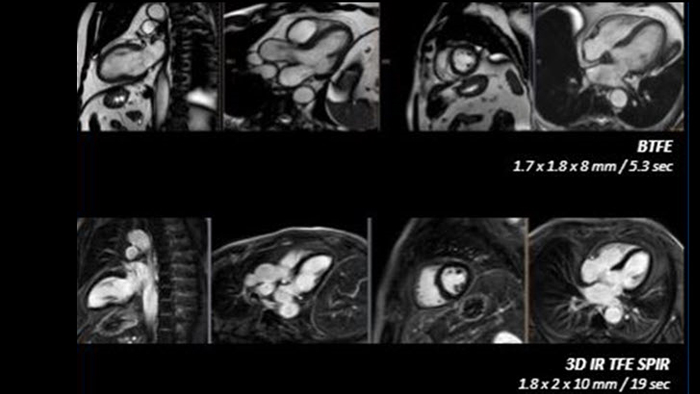 Hochaufl&ouml;sende diagnostische Bildgebung