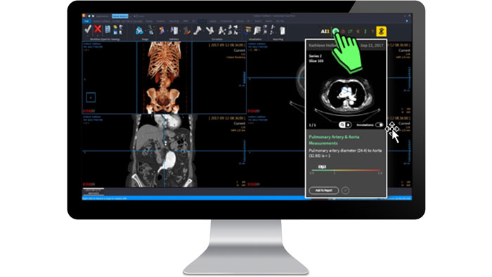 Benutzeroberfl&auml;che der klinischen Auswertungen auf einem Monitor