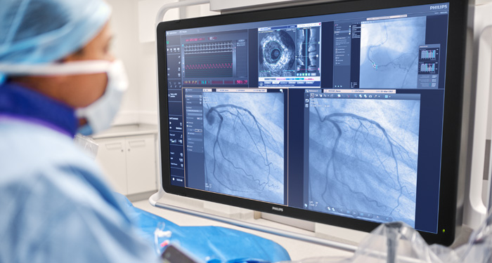 Syst&egrave;mes de radiographie interventionnelle
